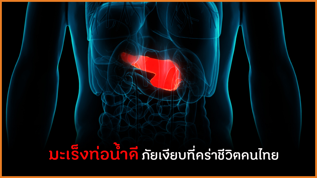 กรมกิจการผู้สูงอายุ ขอนำเสนอสาระน่ารู้ด้านสุขภาพเรื่อง มะเร็งท่อน้ำดี ภัยเงียบที่คร่าชีวิตคนไทย